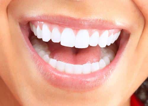 Close-up of a person's bright, white smile showing healthy teeth and gums.