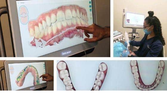 Dental professional pointing at digital display of teeth models and orthodontic treatment plans during patient consultation.