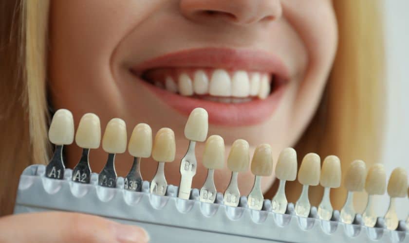 Cosmetic Dentistry in Loxahatchee, FL - Groves Dental Care