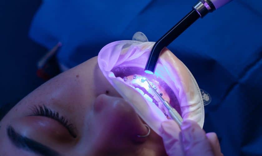 Which Cosmetic Dental Procedure Is Suitable For Fixing Crooked Teeth?