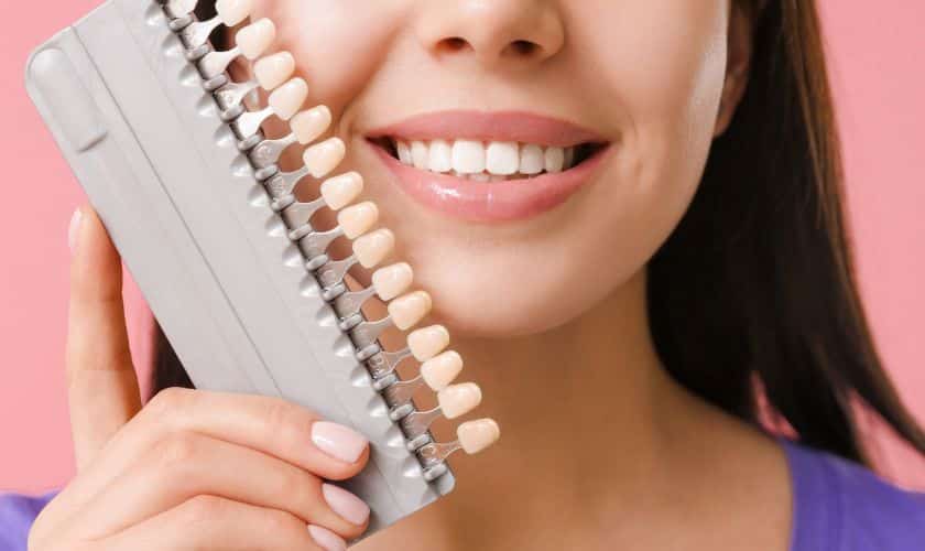 dental veneers post procedure
