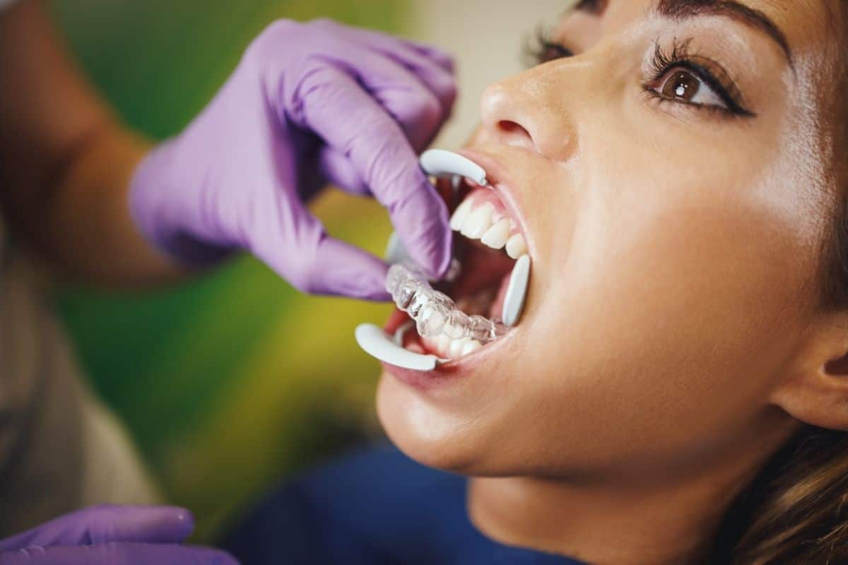 Dentist in purple gloves examining patient's open mouth during dental checkup.