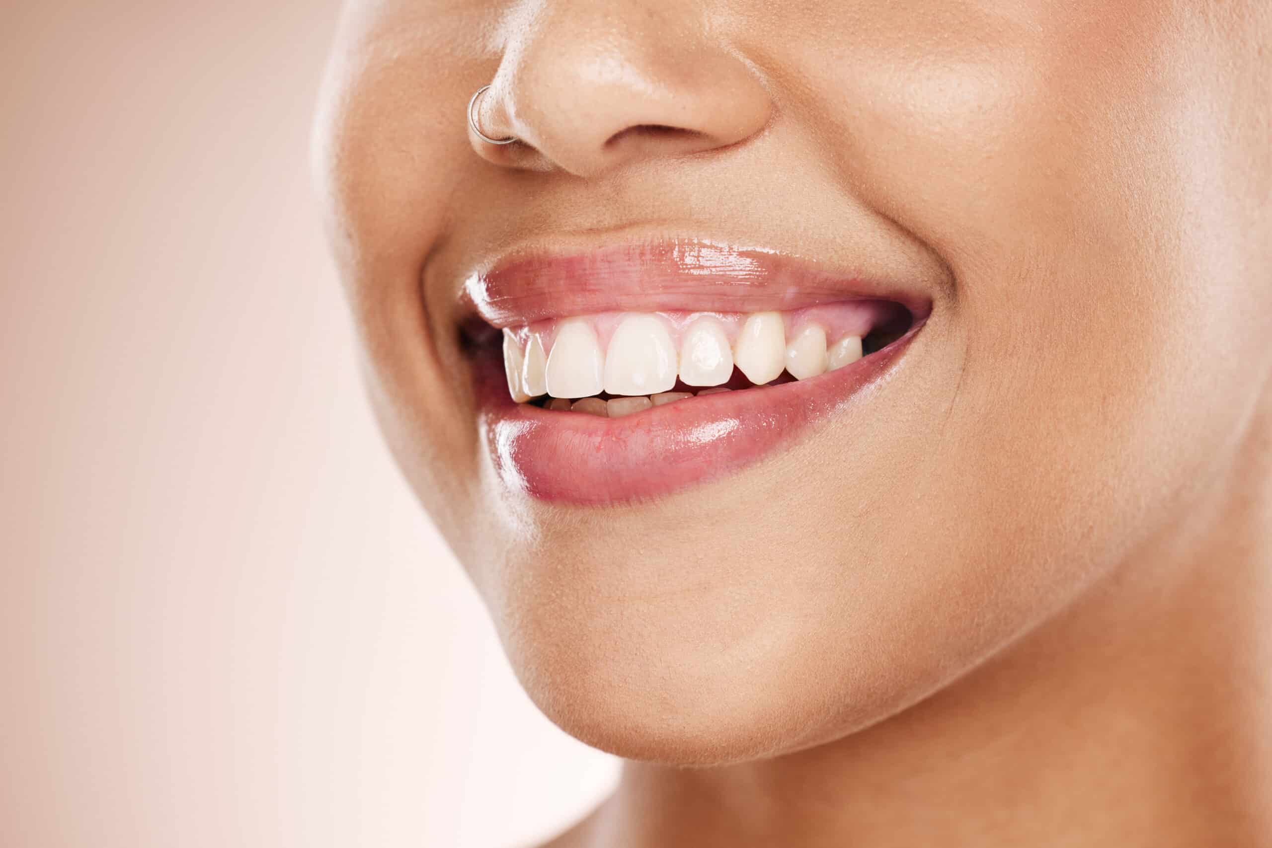 Close-up of woman's smiling face showing white, healthy teeth and natural complexion.